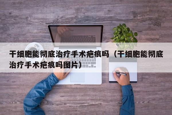 干细胞能彻底治疗手术疤痕吗（干细胞能彻底治疗手术疤痕吗图片）