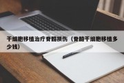 干细胞移植治疗脊髓损伤（脊髓干细胞移植多少钱）