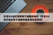 弥漫大b淋巴瘤要做干细胞移植吗（弥漫大b淋巴瘤自体干细胞移植复发率很高吗）
