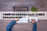 干细胞填充后出现硬块还红怎么办（干细胞填充后皮肤会无故红肿）