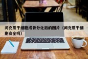 间充质干细胞成骨分化后的图片（间充质干细胞安全吗）