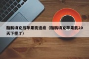 脂肪填充后苹果肌遗症（脂肪填充苹果肌20天下垂了）
