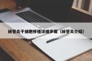 脉管炎干细胞移植详细步骤（脉管炎介绍）