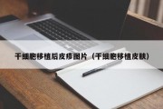 干细胞移植后皮疹图片（干细胞移植皮肤）