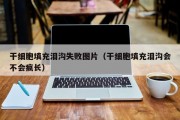 干细胞填充泪沟失败图片（干细胞填充泪沟会不会疯长）
