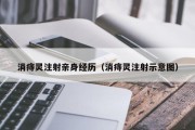 消痔灵注射亲身经历（消痔灵注射示意图）
